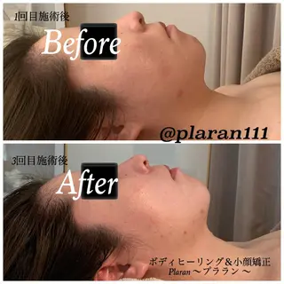 Plaran 〜プララン 〜のその他イメージ