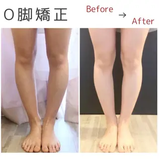 小顔モニター 募集のエステ・リラクイメージ