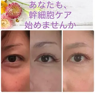 Chura家 幹細胞ケア専門サロンのエステ・リラクイメージ