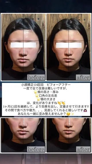 💎後悔させない小顔 矯正💎イトヤマ🌱のエステ・リラクイメージ