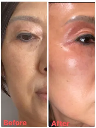 リラクゼーション ルナのエステ・リラクイメージ