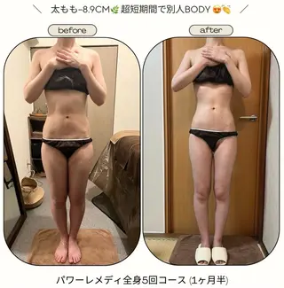 《本気痩せ×疲労改善 》  BILOOPのエステ・リラクイメージ