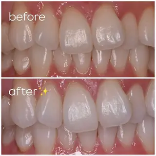 エクシア津駅前店所属・セルフホワイトニング エクシア津駅前店のその他イメージ