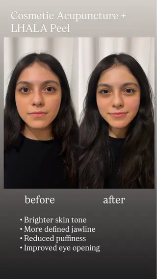 美容鍼灸サロン mahoroba院長のエステ・リラクイメージ