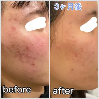 aimer beautyのエステ・リラクイメージ