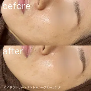 lulularico Yuのエステ・リラクイメージ