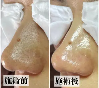 salon soso(ソソ)のエステ・リラクイメージ