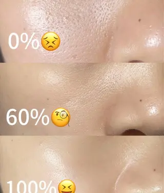 ネイル 愛維美水光美肌専門店所属・愛維美水光美肌専門店 メンズレディースokのエステ・リラクイメージ