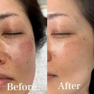 🎀Luana🎀 トータルビューティーのエステ・リラクイメージ