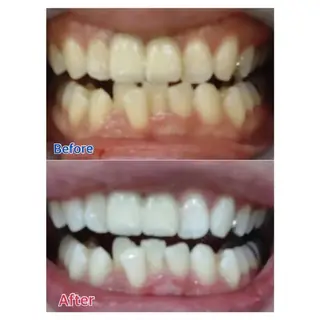 M渋谷 ホワイトニングのエステ・リラクイメージ