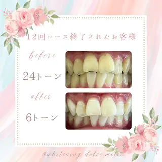 セルフホワイトニング Dolce八王子店のその他イメージ