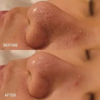 毛穴/肌管理/痩身/ ボディケア/satoのエステ・リラクイメージ