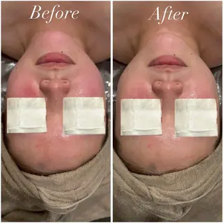 Tulipe Chihoのエステ・リラクイメージ