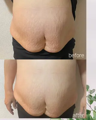 ENOA所属・コルギ/全身リンパ saoriのエステ・リラクイメージ