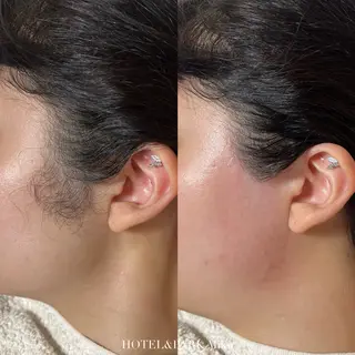 HOTEL&PARK Mikuワックス脱毛のエステ・リラクイメージ