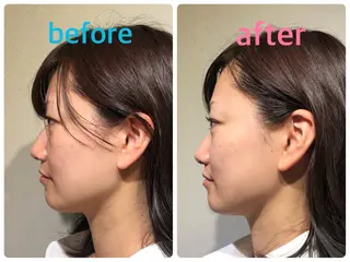 安眠ヘッドスパ整体 🌿白金/目黒/鈴木のエステ・リラクイメージ