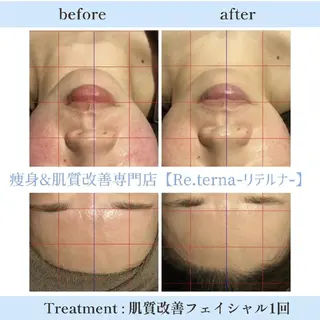 肌質改善専門店 Re.terna田辺のエステ・リラクイメージ