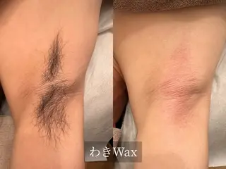 脱毛サロン Arumのエステ・リラクイメージ