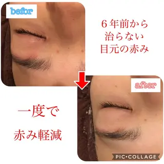 カラー パーマ ヘアアレンジ メンズ キッズ ネイル マツエク・マツパ 金の糸脱毛 産毛ケア専門のエステ・リラクイメージ