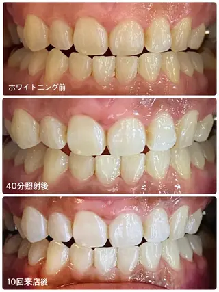 ホワイトニングサロン ラウレアのその他イメージ