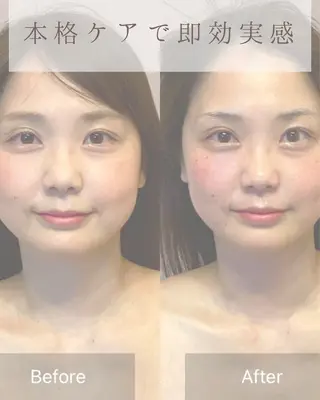 美肌エイジングケアサロンIB所属・IB 内藤のエステ・リラクイメージ