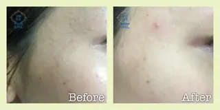 美肌脱毛フェイシャル サロンAMOのエステ・リラクイメージ