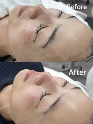 小顔専門看護師クリニカルサロンCOCO所属・小顔と美肌サロン クリニカルサロンココのエステ・リラクイメージ