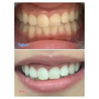 M渋谷 ホワイトニングのエステ・リラクイメージ