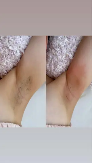 Honey Salonのマツエク・マツパデザイン