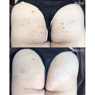 毛穴/毛穴洗浄専門 エミルカ船橋のエステ・リラクイメージ