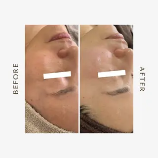 1st｜フェイシャル エステ専門店のエステ・リラクイメージ