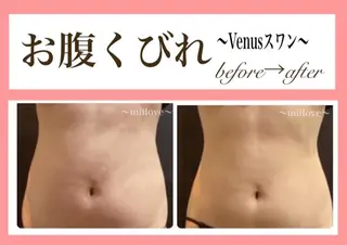 miilove 鹿児島店のエステ・リラクイメージ