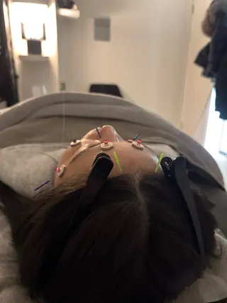 美容鍼×小顔矯正 ×美容整体　浜川泰仁のエステ・リラクイメージ