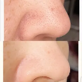 Laul🦖 Motohashiのマツエク・マツパデザイン