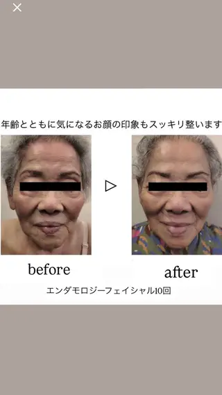 Binosu所属・エンダモロジー BINOSUのエステ・リラクイメージ