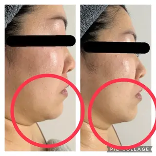 BeautySalonGemmy所属・Gemmy 愛美のエステ・リラクイメージ