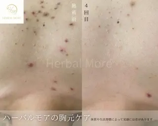 脱毛・眉毛・フェイス サロンN久留米店の眉毛・アイブロウイメージ