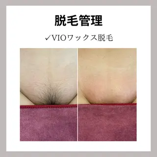 WAX・肌質改善・毛 穴洗浄/林愛真のエステ・リラクイメージ