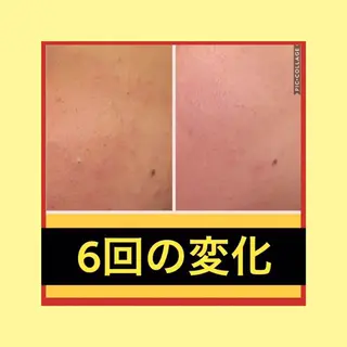 ミディアム パーマ ヘアアレンジ メンズ キッズ ネイル マツエク・マツパ ニキビ・肌質改善専門 ♡人生が変わるサロンのエステ・リラクイメージ