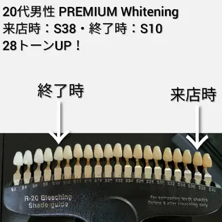 メンズ 美歯口工房セルフホワイトニングMilky所属・竜沢 佳典のエステ・リラクイメージ