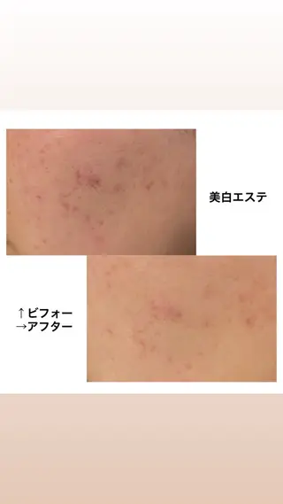 Coco Calin 𓇼山脇愛のエステ・リラクイメージ