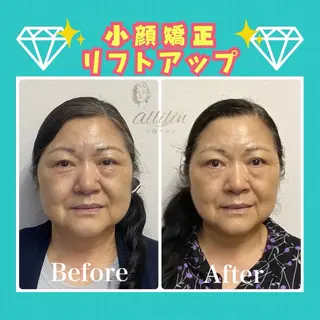 小顔サロンallilin所属・💎allilin 五所川原💎本間のエステ・リラクイメージ