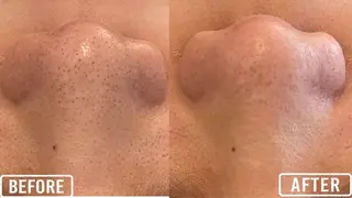 毛穴/毛穴洗浄専門 エミルカ船橋のエステ・リラクイメージ