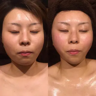 小顔やたるみに特化 💚野瀬可蓮のその他イメージ