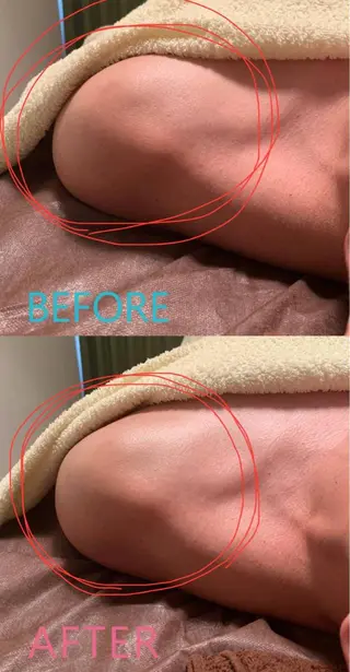 ハウオリベリー所属・うえば すみかのエステ・リラクイメージ