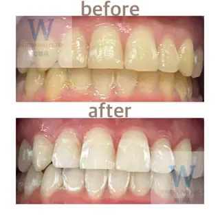 ホワイトニング ショップ船橋２号店のエステ・リラクイメージ