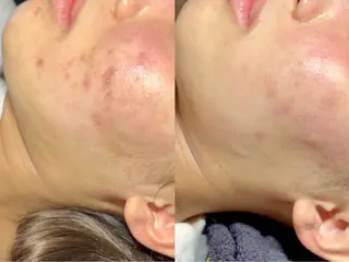 ニキビ・毛穴・肌荒れ &me 西宮北口店のその他イメージ