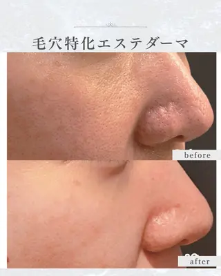 シミ取り×毛穴エステ YUKIのエステ・リラクイメージ