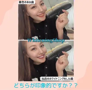 ホワイトニング ショップ伊丹店のその他イメージ