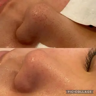 SOYOU所属・岡崎🦋SOYOU 韓国肌管理のエステ・リラクイメージ